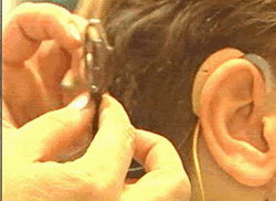 Cochlear implants benefit children in Sancti Spiritus, Cuba